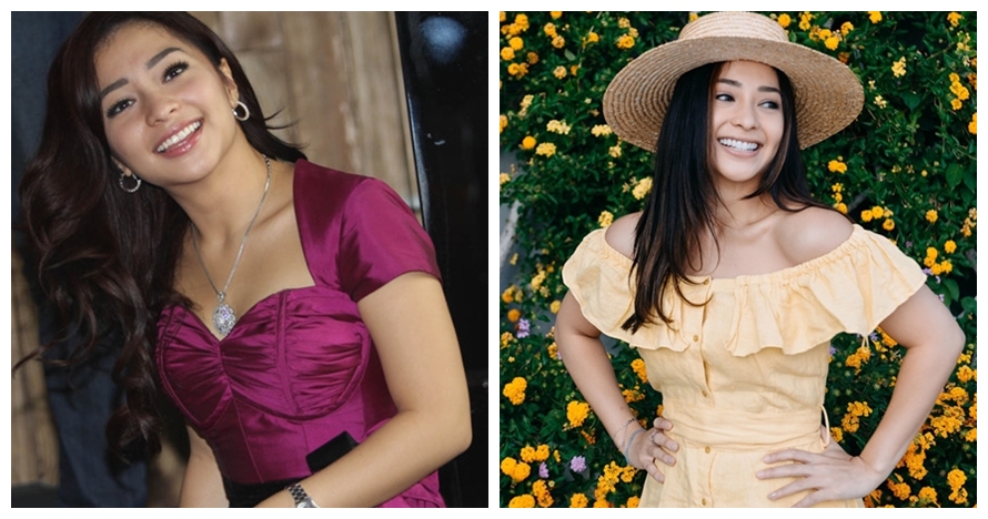 Potret 10 seleb cantik sebelum vs sesudah veneer gigi, manglingi