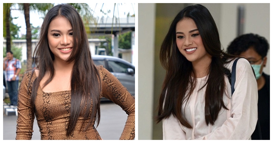 Potret 10 seleb cantik sebelum vs sesudah veneer gigi, manglingi