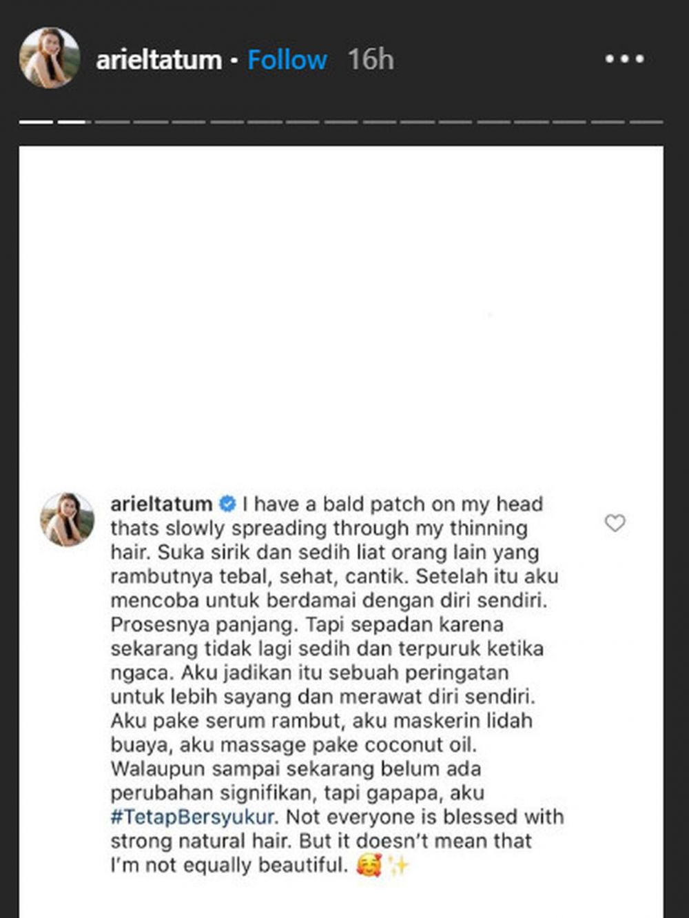 Ariel Tatum alami gejala kebotakan, sikapnya ini bikin salut