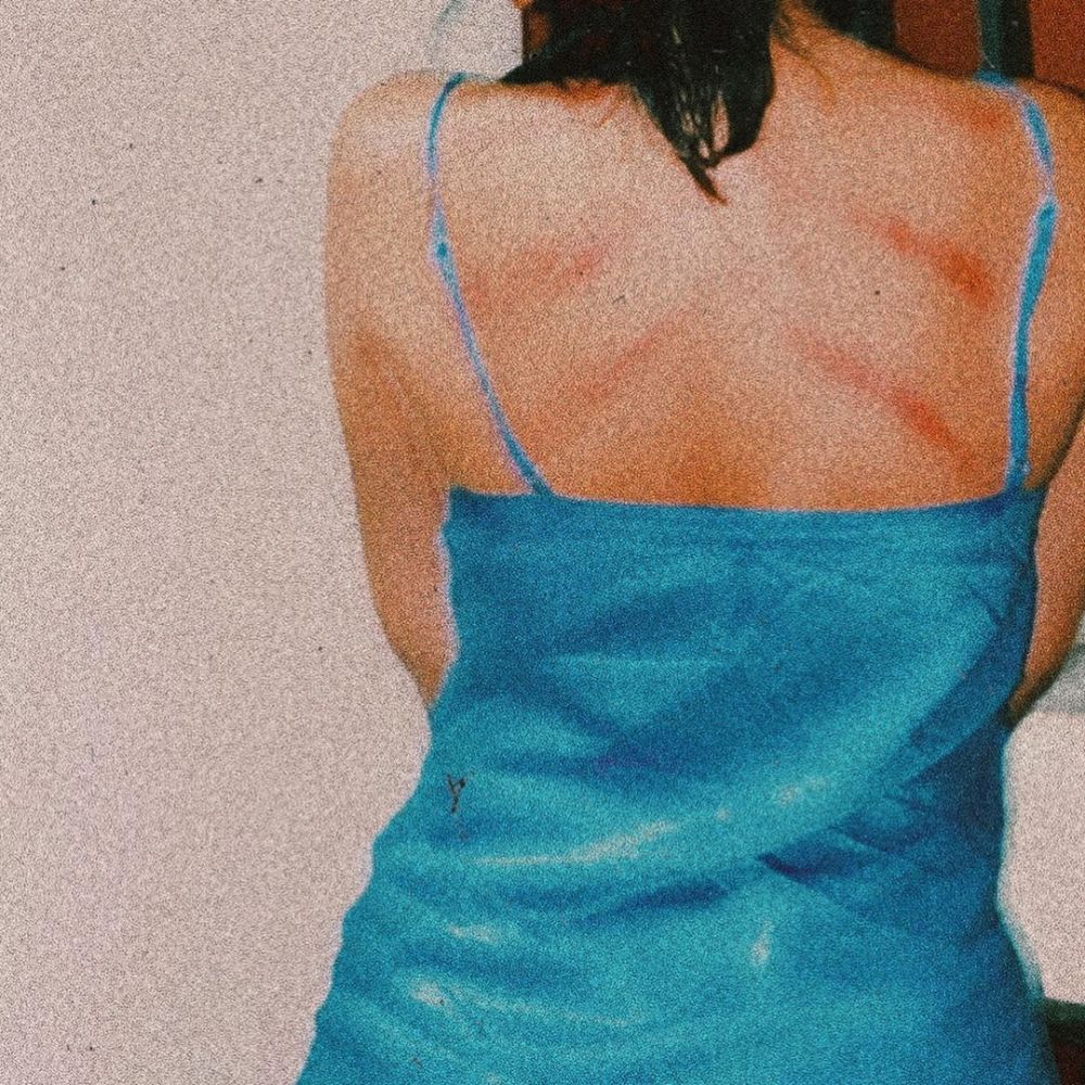 Unggah potret punggung kerokan, Marion Jola bikin salah fokus