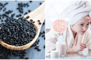 7 Manfaat Habbatussauda untuk kulit, bisa atasi jerawat