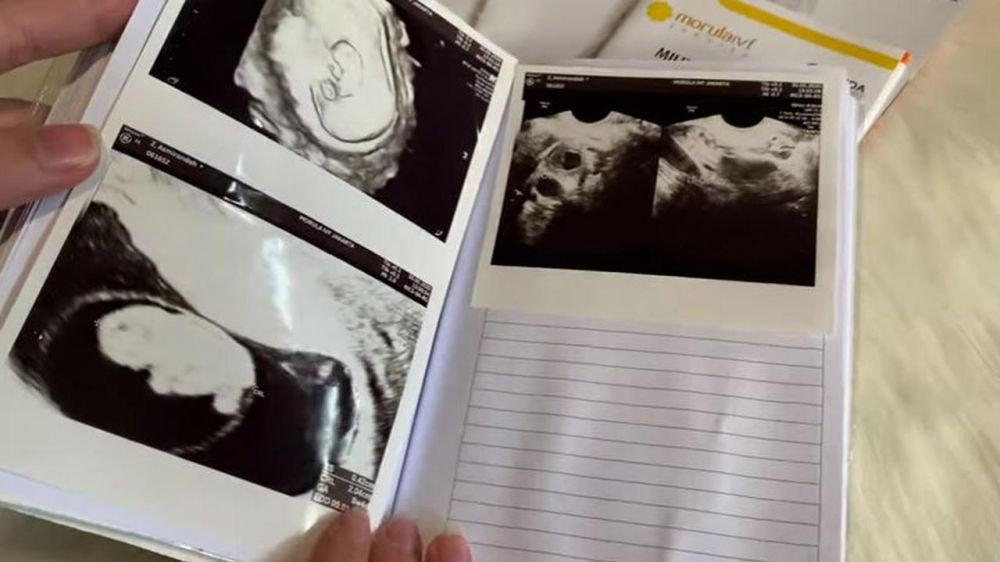 5 Cerita perjuangan Asmirandah hamil anak pertama, menanti 7 tahun