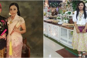 Ingat Lisa 'face off' korban siram air keras? Ini 6 kabar terkininya