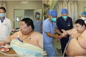 Kisah pria bertambah berat badan hingga 100 kg saat lockdown