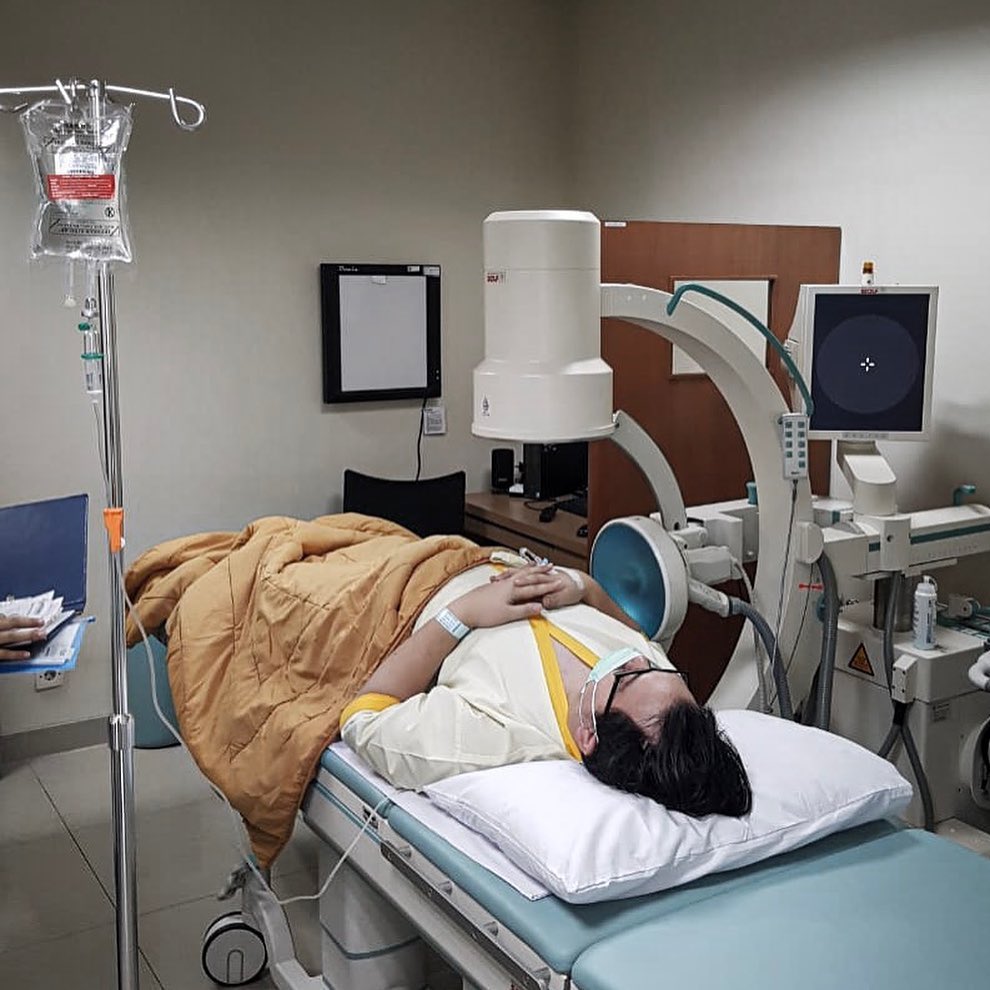 3 Cerita di balik operasi batu ginjal Chandra Liow, obesitas 115 kg