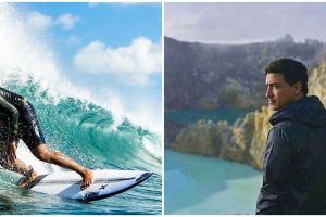 Hamish Daud unggah foto X-Ray tengkorak kepalanya, penuh baut