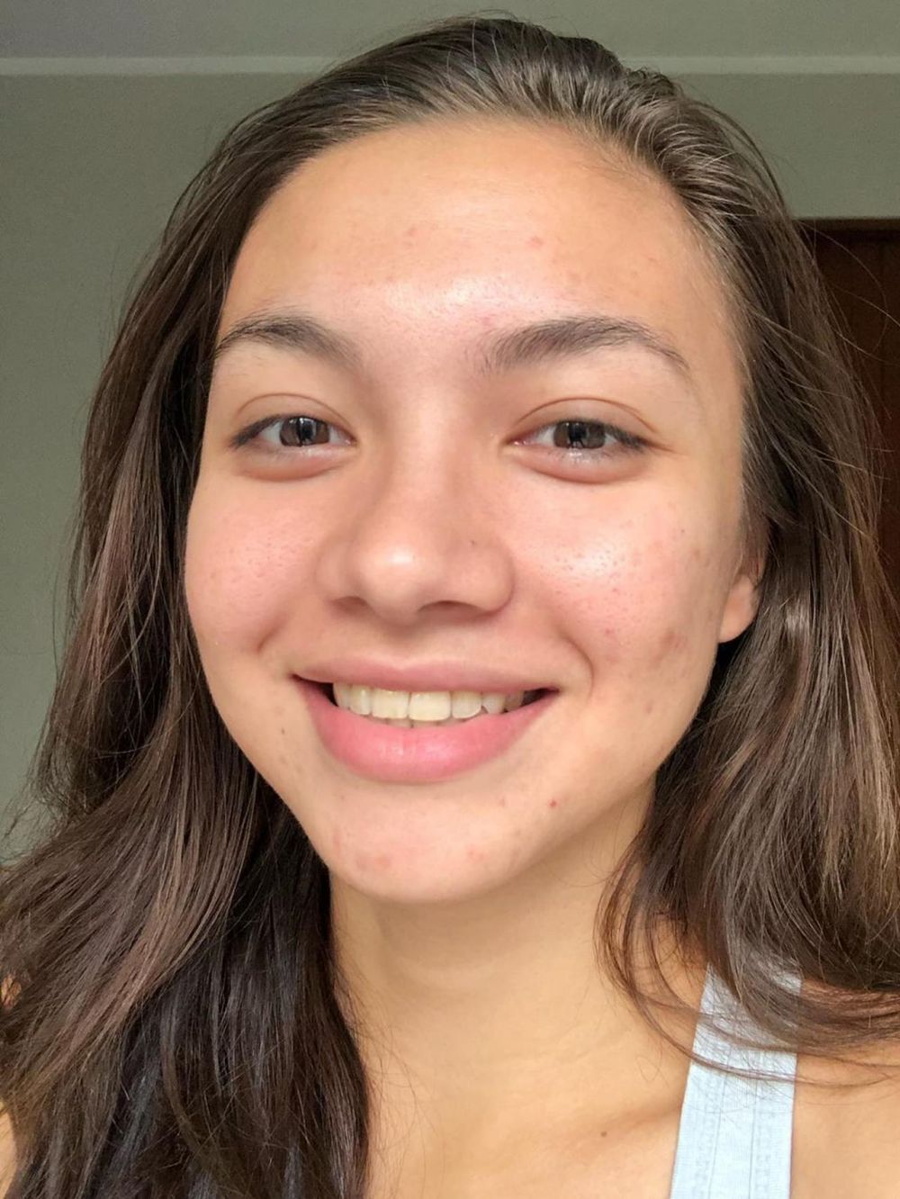 7 Potret Angela Gilsha tanpa makeup, percaya diri tampil jerawatan