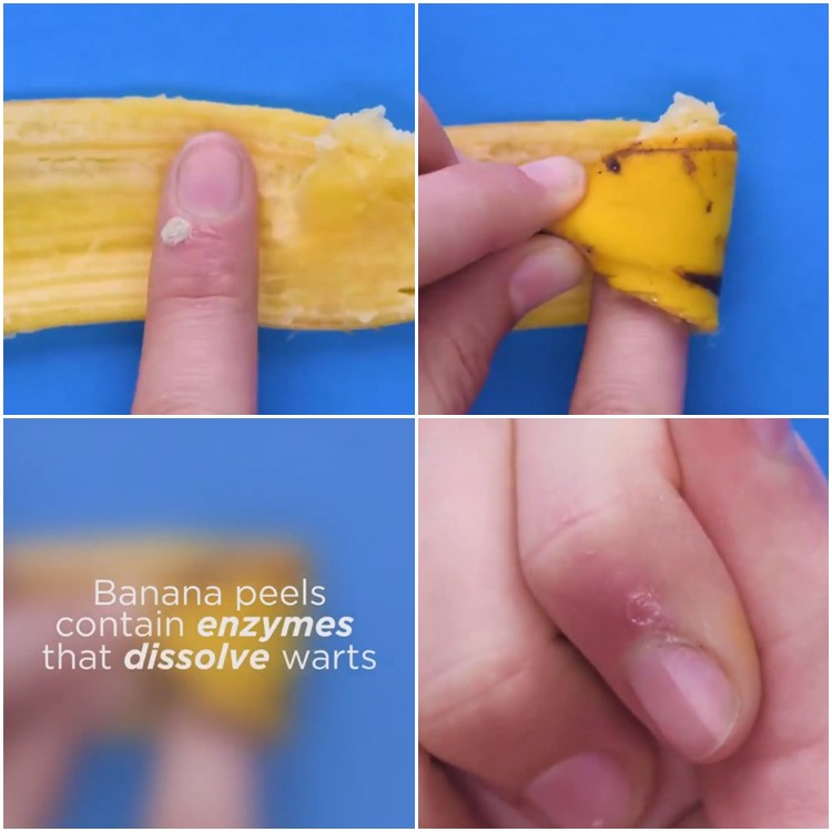 6 Life hack merawat tubuh dengan bahan alami, mudah banget