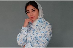 Potret perbedaan wajah Nikita Willy sebelum & usai botox, tampil beda