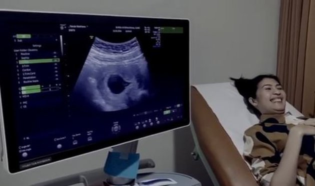 7 Cerita perjuangan istri Naga Eks Lyla hamil anak pertama