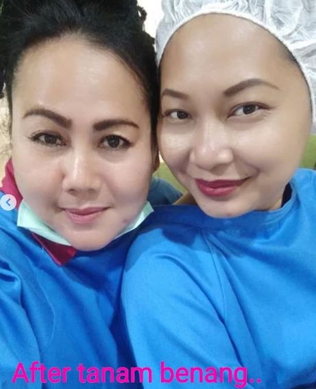 Ingat Parti istri Ucup Bajaj Bajuri? 9 potret terbarunya ini manglingi