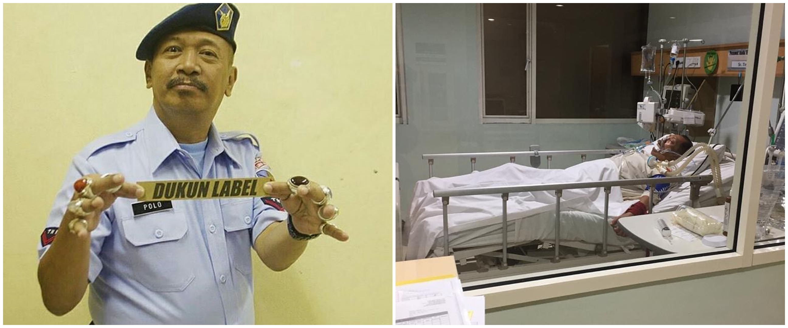 5 Fakta kondisi Polo Srimulat dirawat di ICU, sakit paru-paru