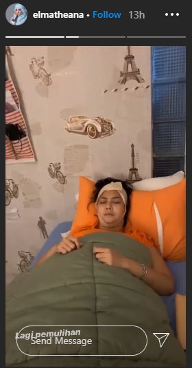 7 Potret perubahan wajah Rency Milano usai perawatan kecantikan