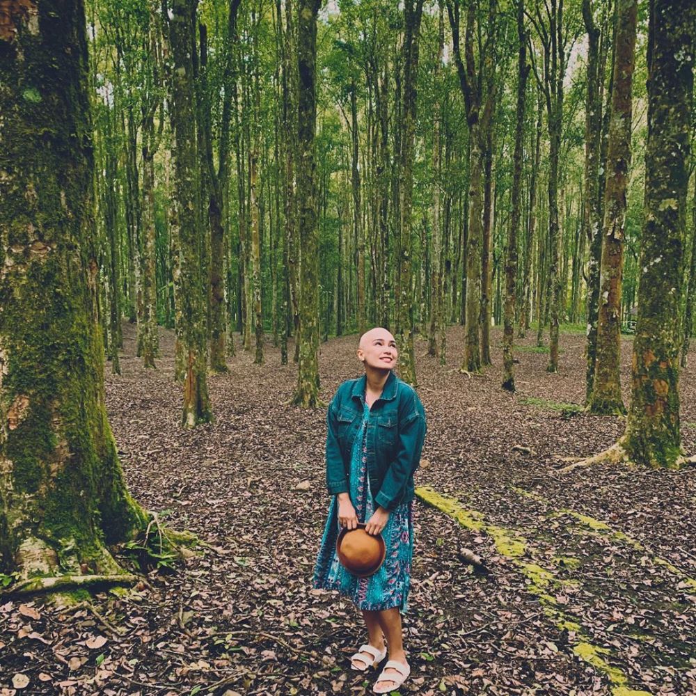 7 Potret Feby Febiola dengan tampilan plontos usai kemoterapi