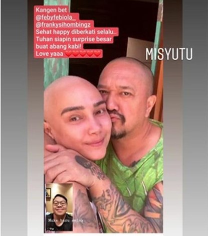 7 Potret Feby Febiola dengan tampilan plontos usai kemoterapi