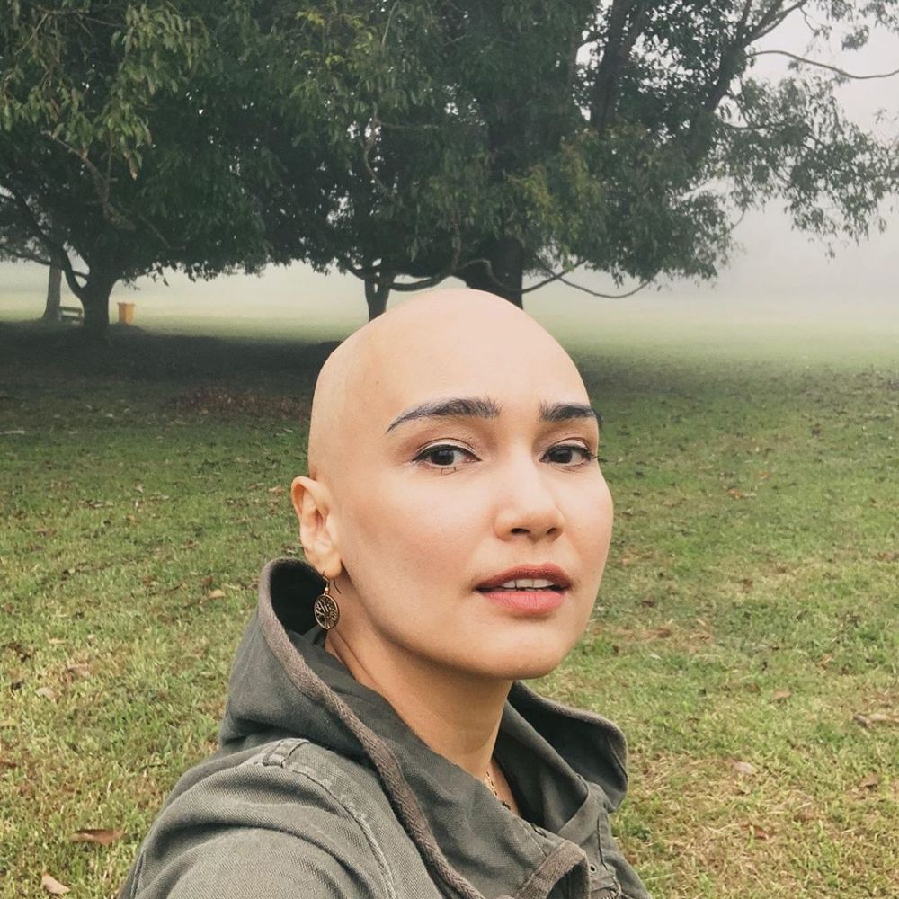 Tampil dengan rambut plontos, Feby Febiola ungkap penyakitnya