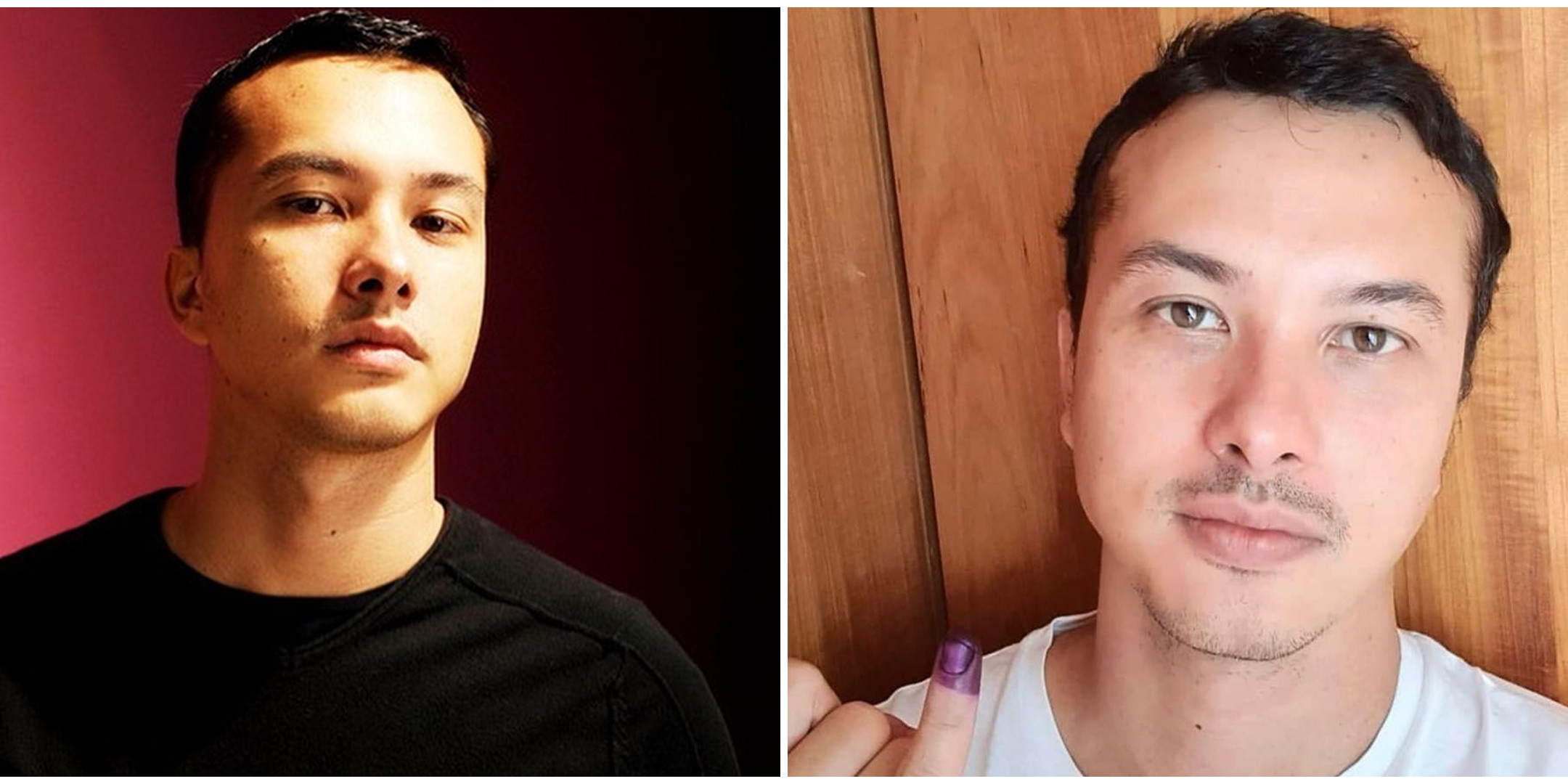 Nicholas Saputra pamer kaki di Instagram, warganet heboh