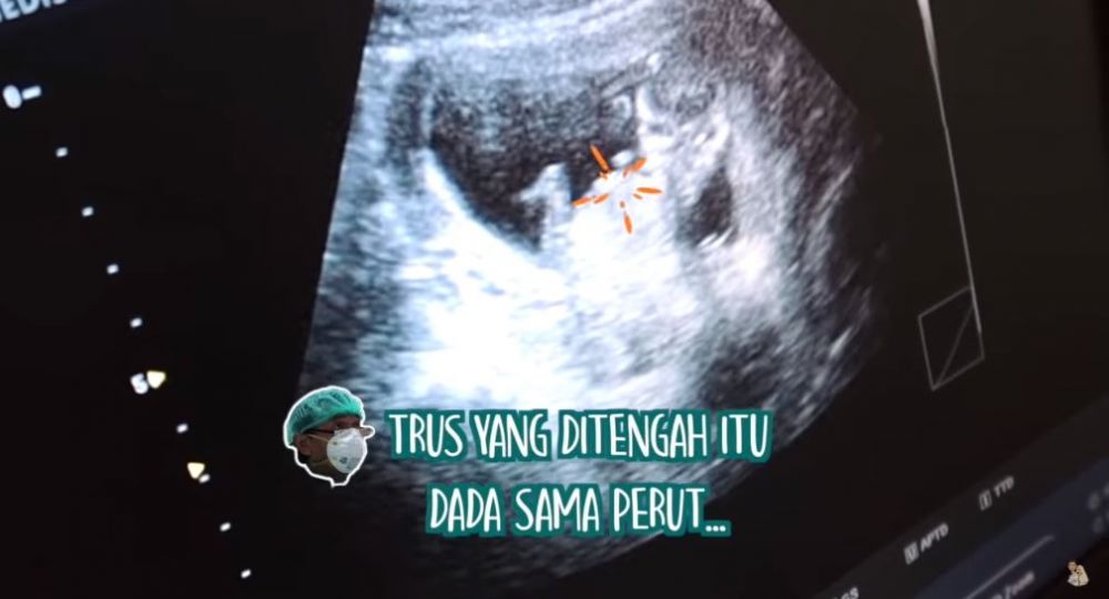 7 Momen Vebby Palwinta umumkan kehamilan, jadi kado ultah untuk suami