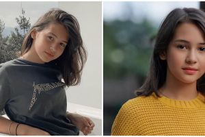 Sandrinna Michelle terbaring di rumah sakit, begini kondisinya