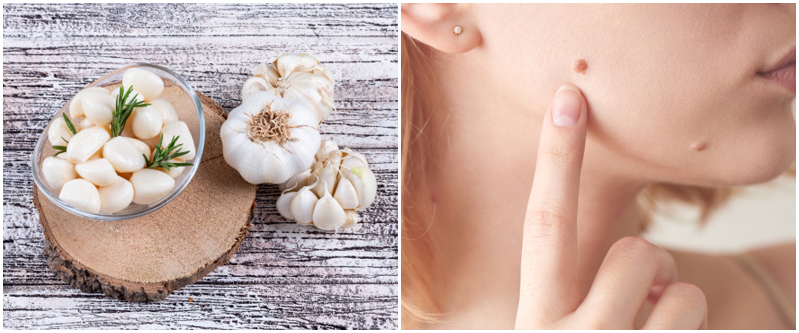 8 Manfaat bawang putih untuk kulit, atasi keriput dan peradangan