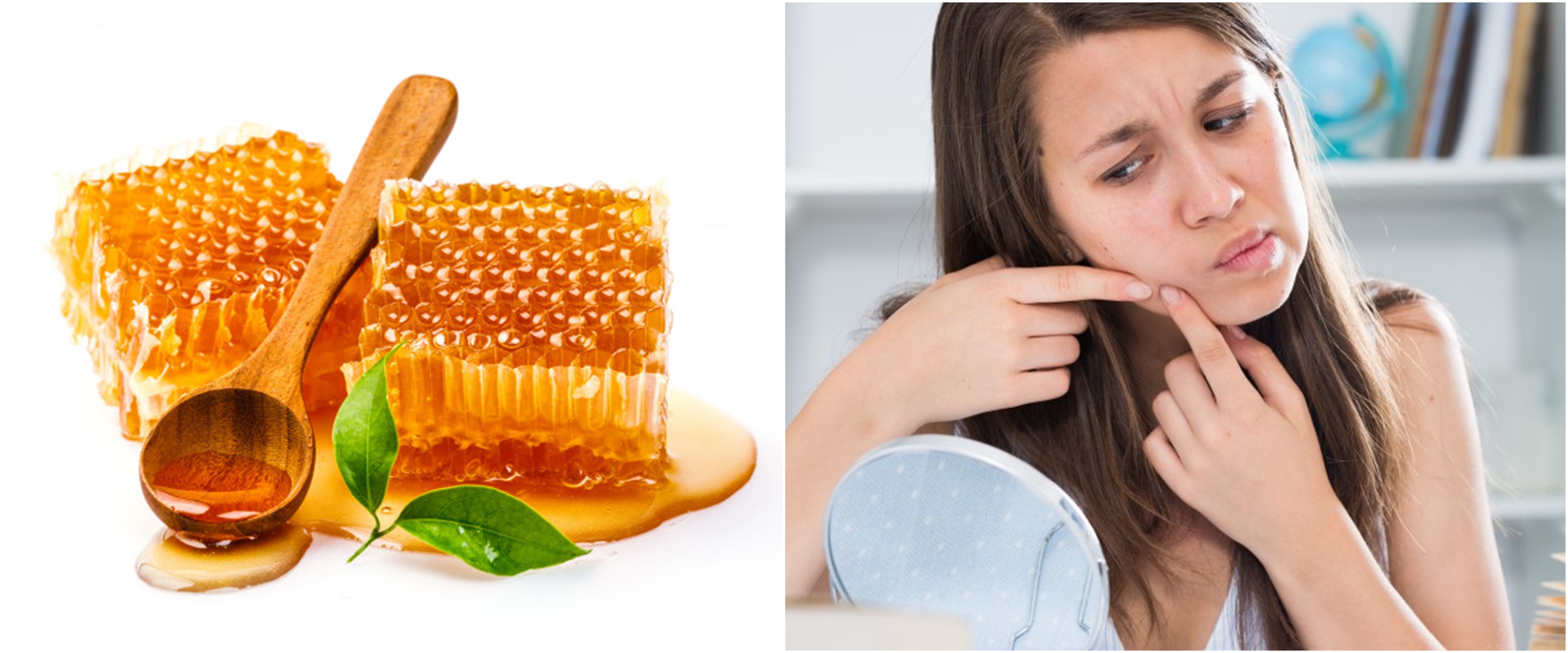 8 Cara mengobati jerawat dengan madu, aman untuk kulit