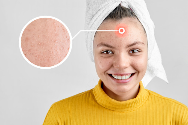 8 Manfaat minyak zaitun untuk wanita, sumber perawatan alami