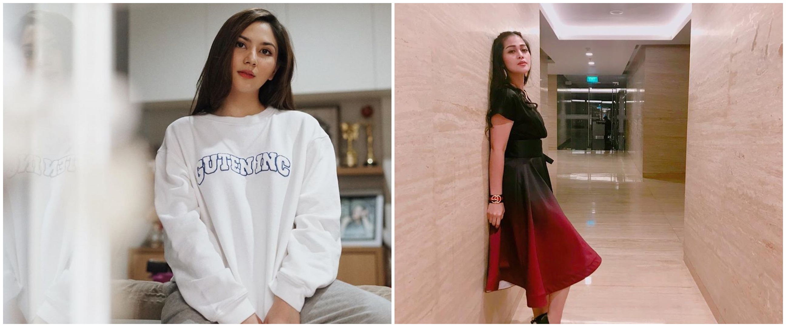 Cerita 5 seleb idap skoliosis, Jessica Mila sudah sejak SMP