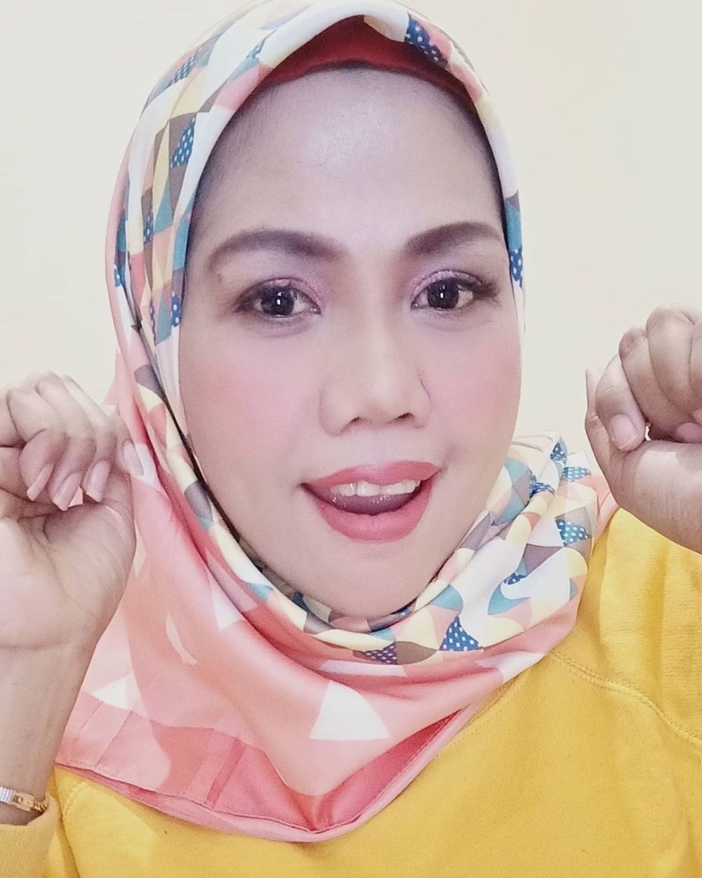 8 Potret terbaru Elly Sugigi usai pengencangan wajah, makin tirus