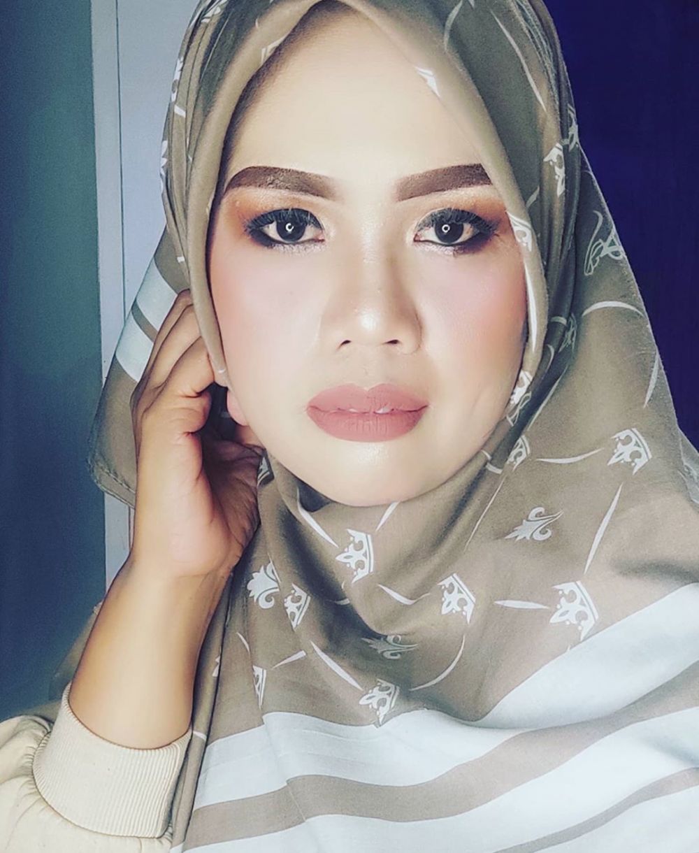 8 Potret terbaru Elly Sugigi usai pengencangan wajah, makin tirus