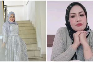 8 Potret terbaru Elly Sugigi usai pengencangan wajah, makin tirus