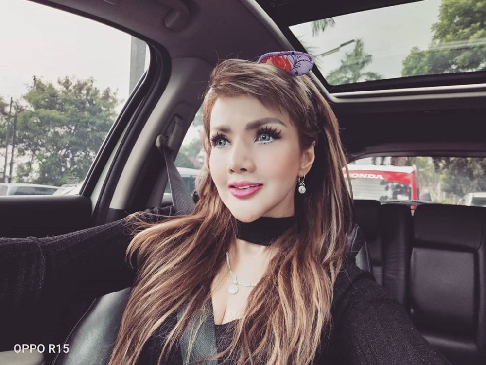 Selain Evelyn Nada, 5 seleb ini pernah jalani sulam bibir