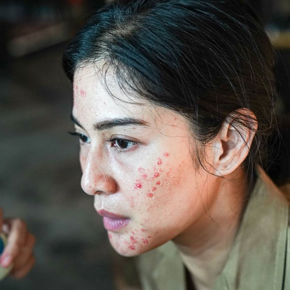 11 Penampilan manglingi Dian Sastro di film Guru-Guru Gokil, jerawatan