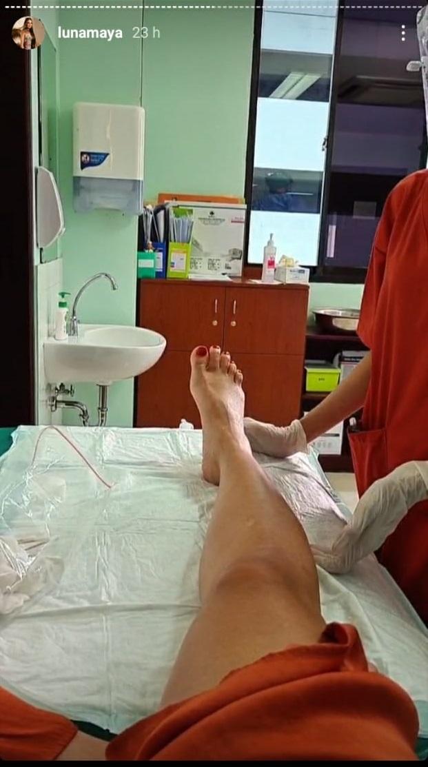 Alami patah tulang, begini 5 potret kondisi Luna Maya