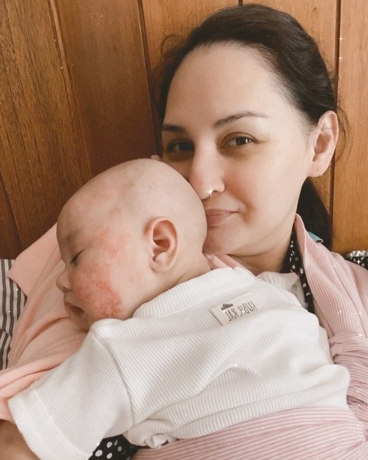 9 Potret perjuangan Mona Ratuliu rawat anak idap dermatitis atopik