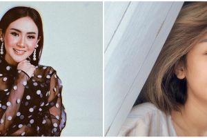 8 Potret perjuangan Cita Citata lawan amandel sampai harus operasi