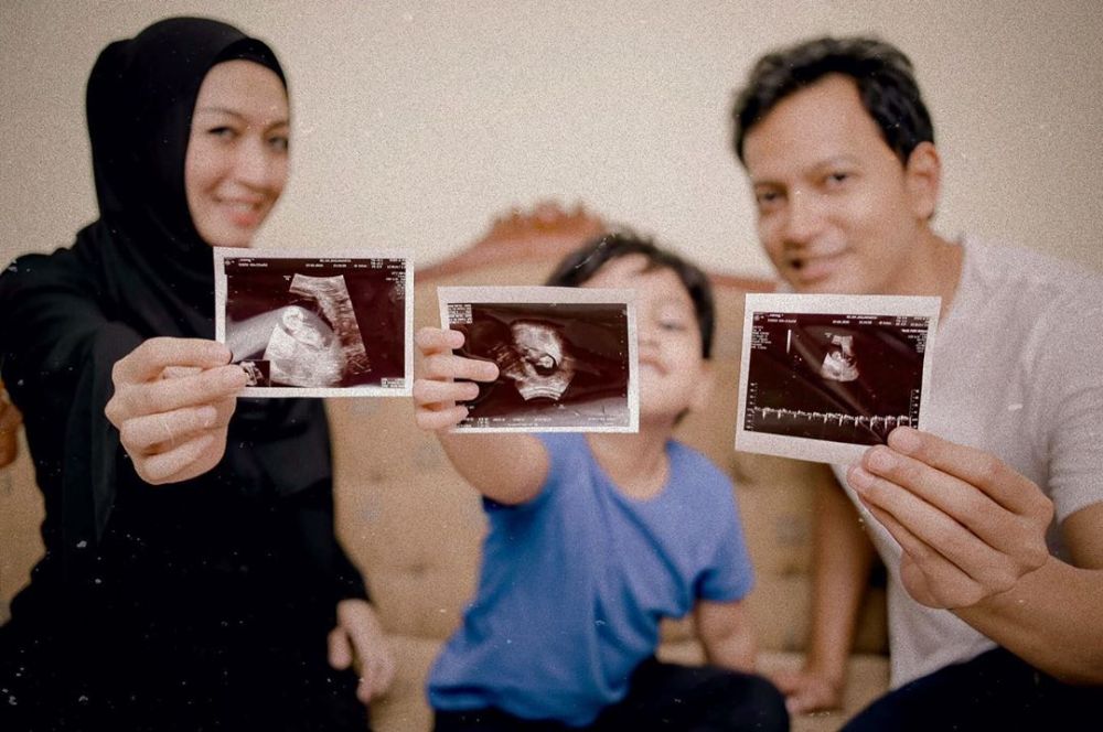 7 Potret baby bump Vanny Widyasasti, istri Fedi Nuril hamil anak kedua