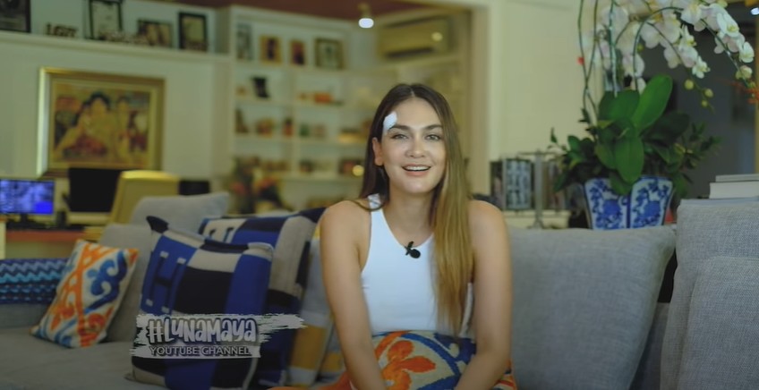 Alami patah tulang, Luna Maya ceritakan kronologinya