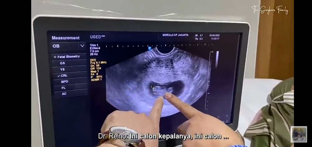 10 Momen Zaskia Sungkar cek kandungan pertama kali, penuh syukur