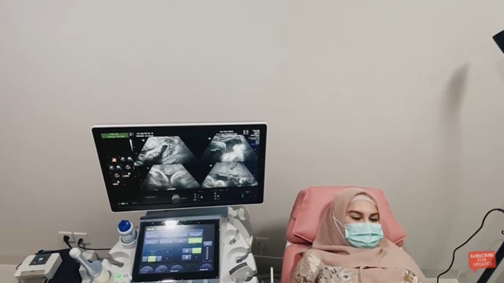 Proses persalinan kemungkinan dipercepat, ini persiapan Irish Bella