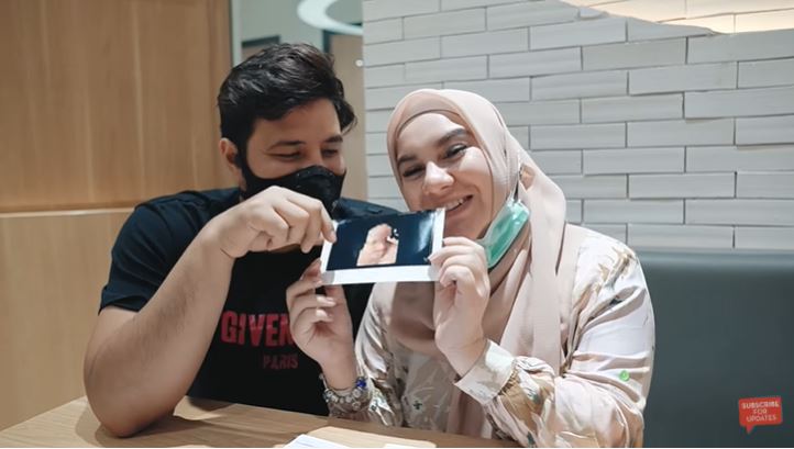 Proses persalinan kemungkinan dipercepat, ini persiapan Irish Bella