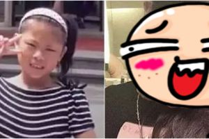 Kisah gadis 15 tahun operasi wajah hingga 100 kali demi seperti boneka