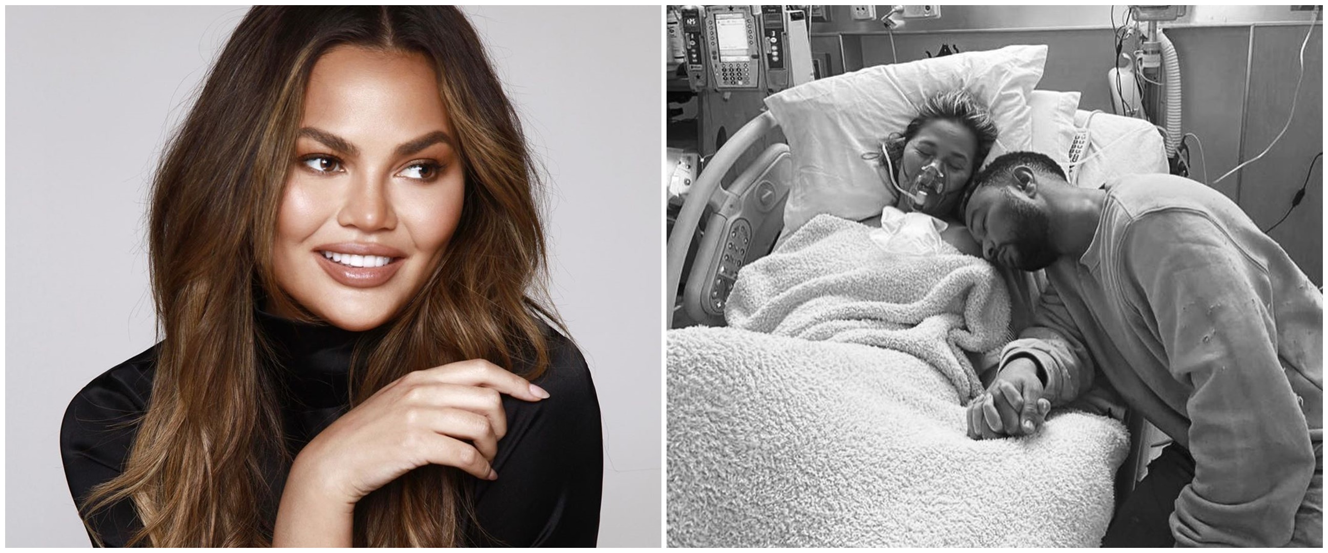 5 Potret sedih Chrissy Teigen di RS usai keguguran & pendarahan hebat