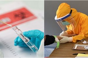 Prosedur penangan pasien Covid-19 sesuai gejala dan kriteria sembuhnya