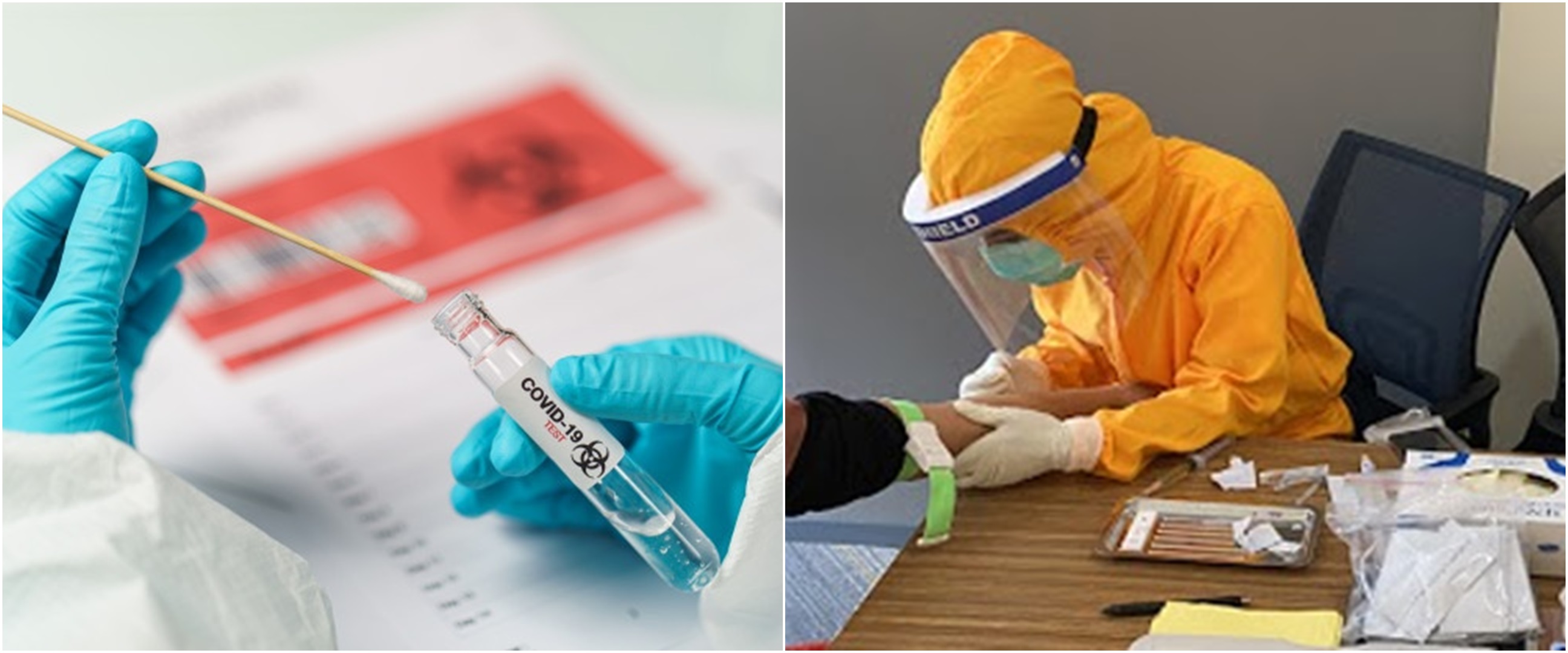 Prosedur penangan pasien Covid-19 sesuai gejala dan kriteria sembuhnya