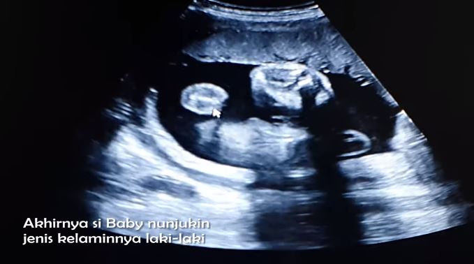 Jelang melahirkan, Sheila Marcia ungkap inisial nama calon anak