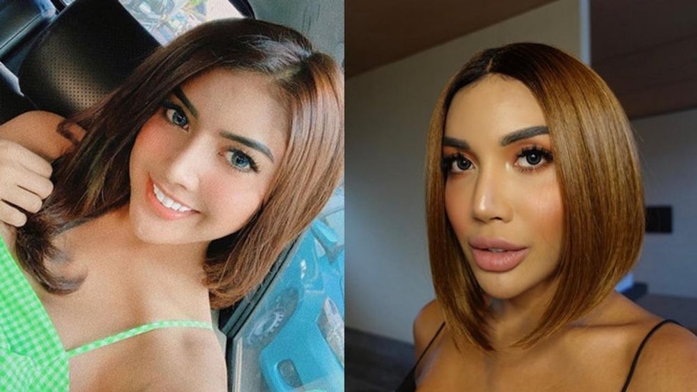 8 Potret terbaru Millen Cyrus setelah filler bibir, manglingi