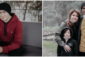 Anji ungkap tangan anaknya kemasukan cacing, begini penampakannya