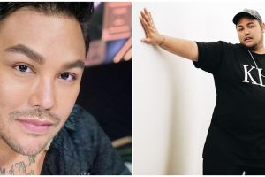 Ini bagian wajah Ivan Gunawan yang dioperasi plastik Rp 1 miliar