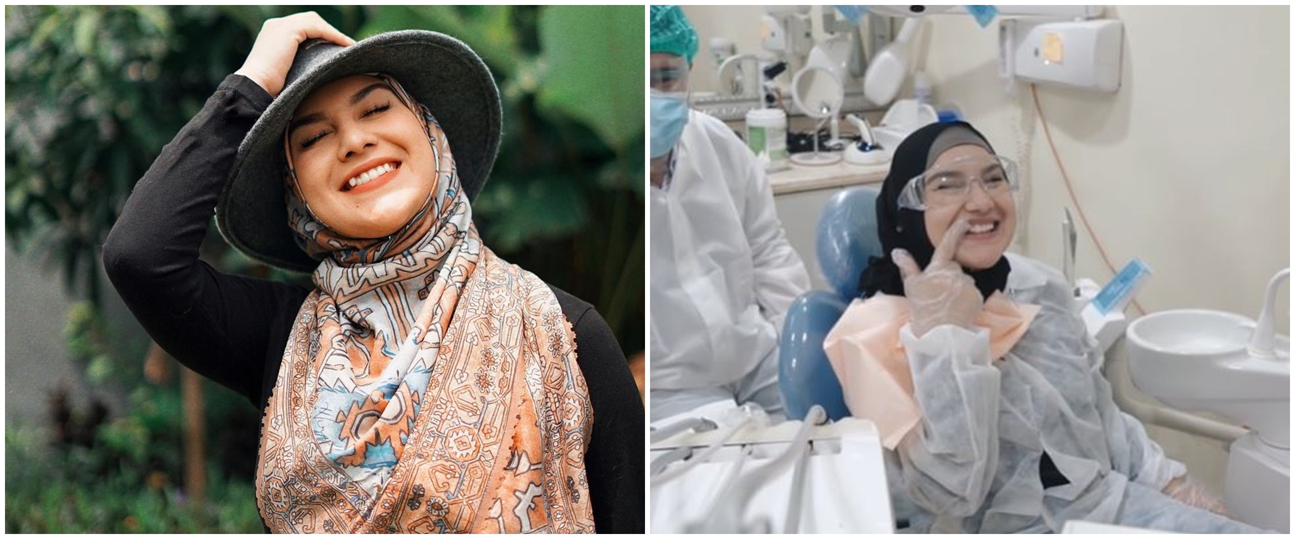 8 Momen Irish Bella perawatan hilangkan gingsul, alasannya tak terduga