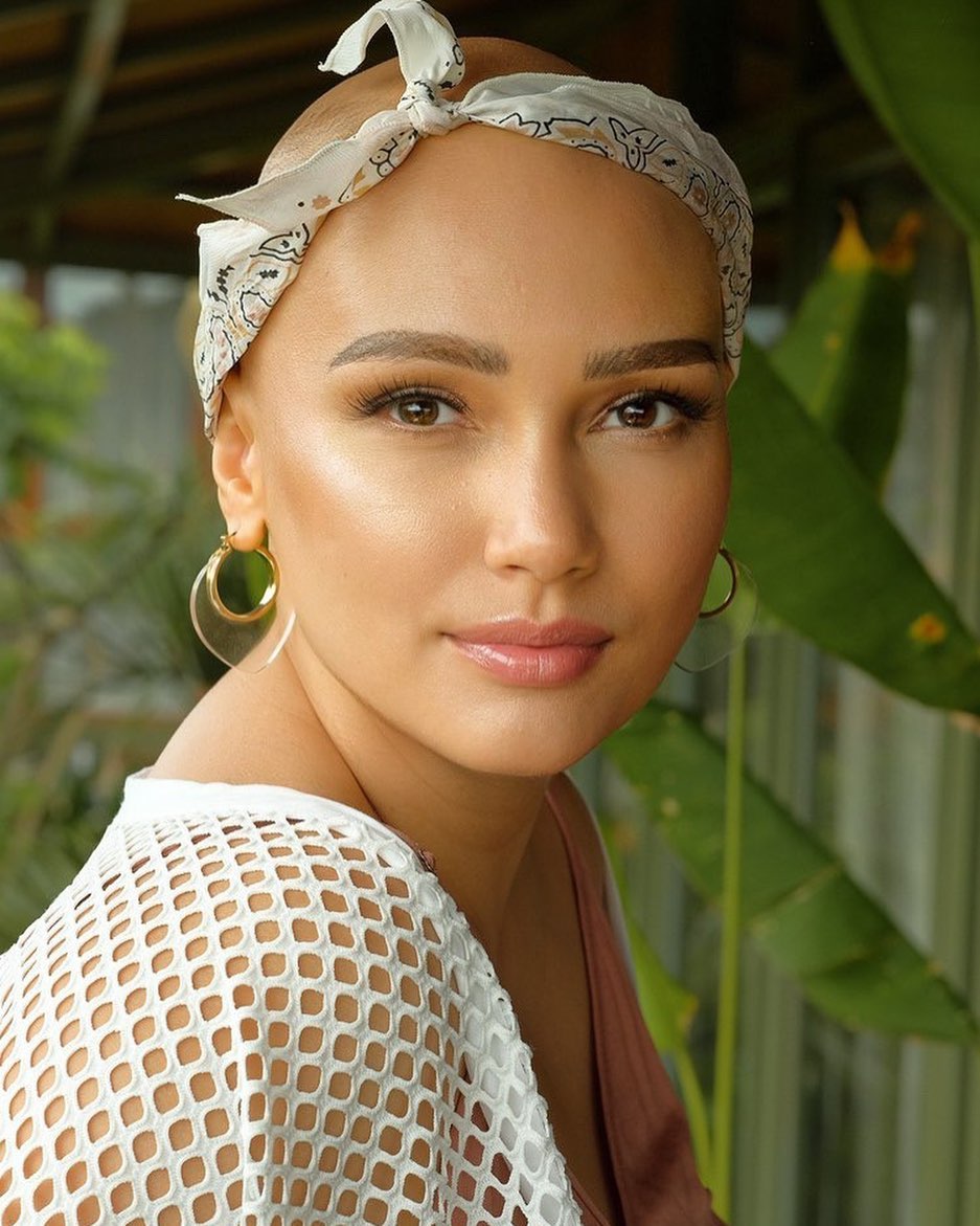 Berhasil sembuh kanker ovarium, Feby Febiola tulis caption menyentuh